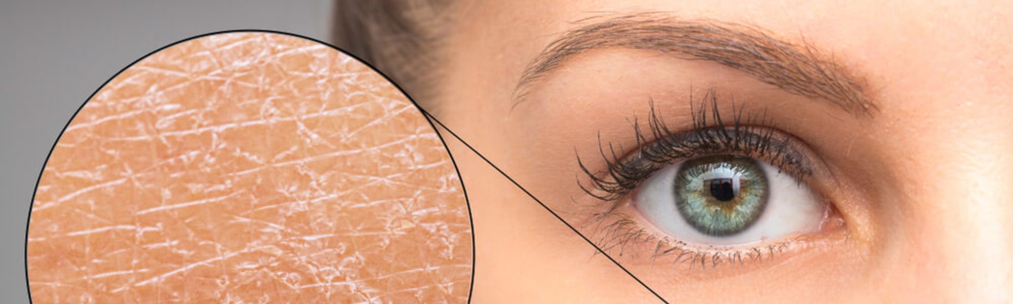 7 Ways on How to Hydrate and Moisturize Dry Skin