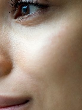 Hyaluronic Acid A Boost Of Hydratio For All Ages Hero