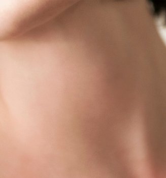 A Guide To Busting Dark Patches Of Skin Hero