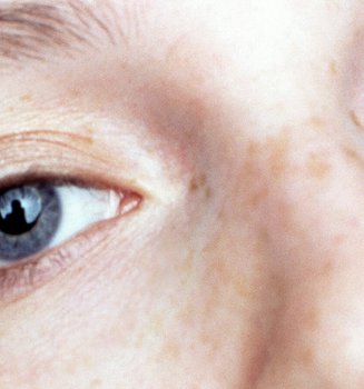 How To Choose The Right Concealer To Banish Dark Circles Hero