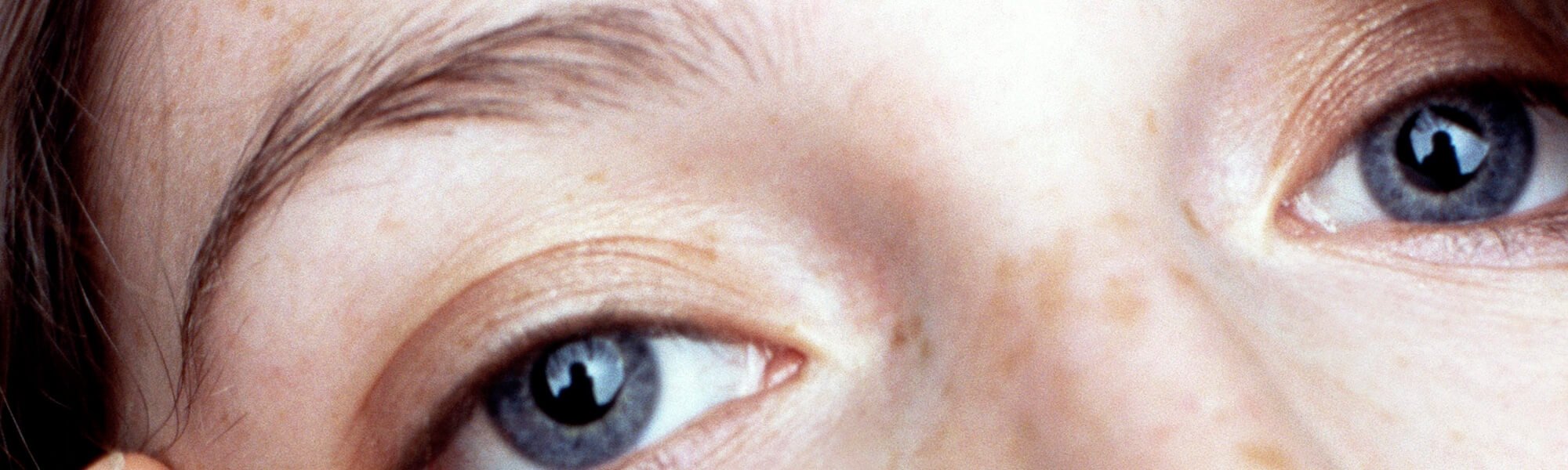 How To Choose The Right Concealer To Banish Dark Circles Hero