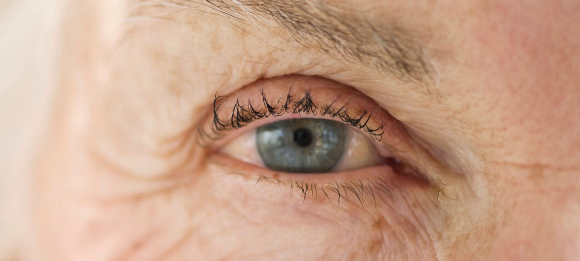 Zap Wrinkles With Phototherapy Hero