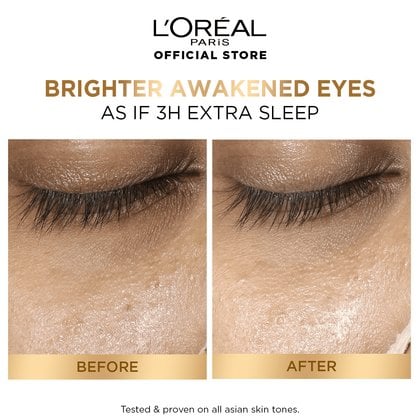 Glyco Eye 03